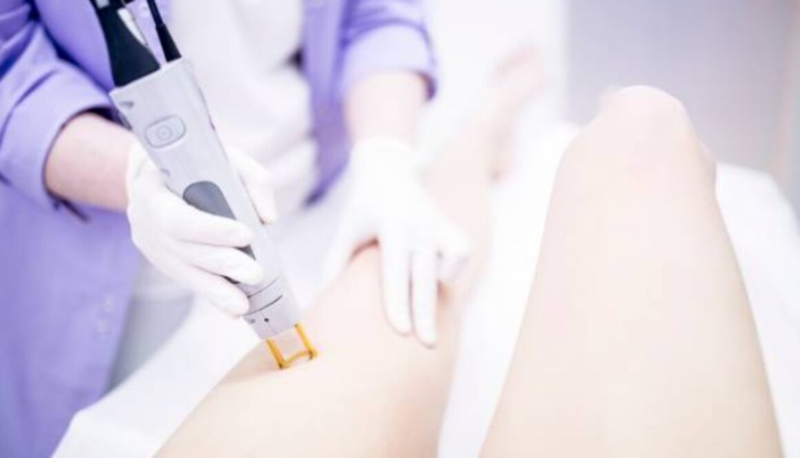 guide to laser hair removal