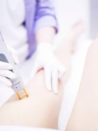 guide to laser hair removal