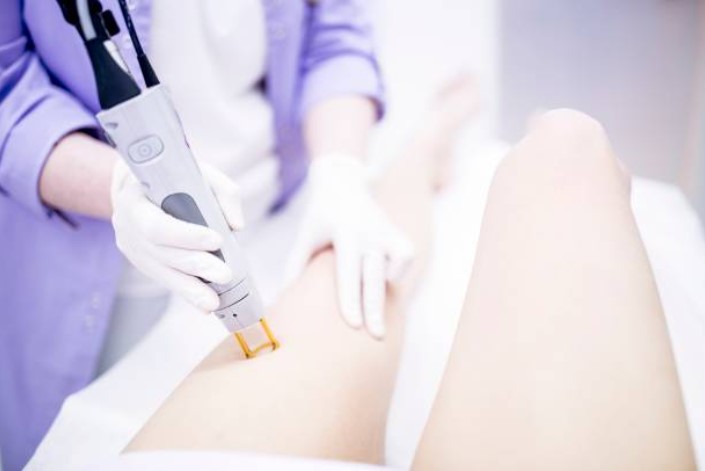 A Complete Guide to Laser Hair Removal